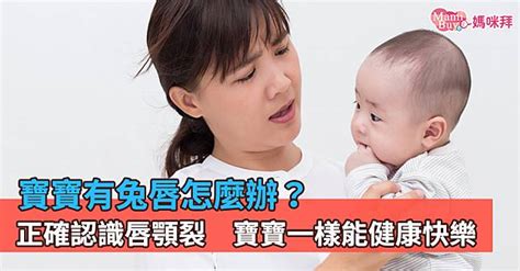 胎兒兔唇|如何照顧兔唇寶寶？兔唇原因為何？一次看懂兔唇定義。